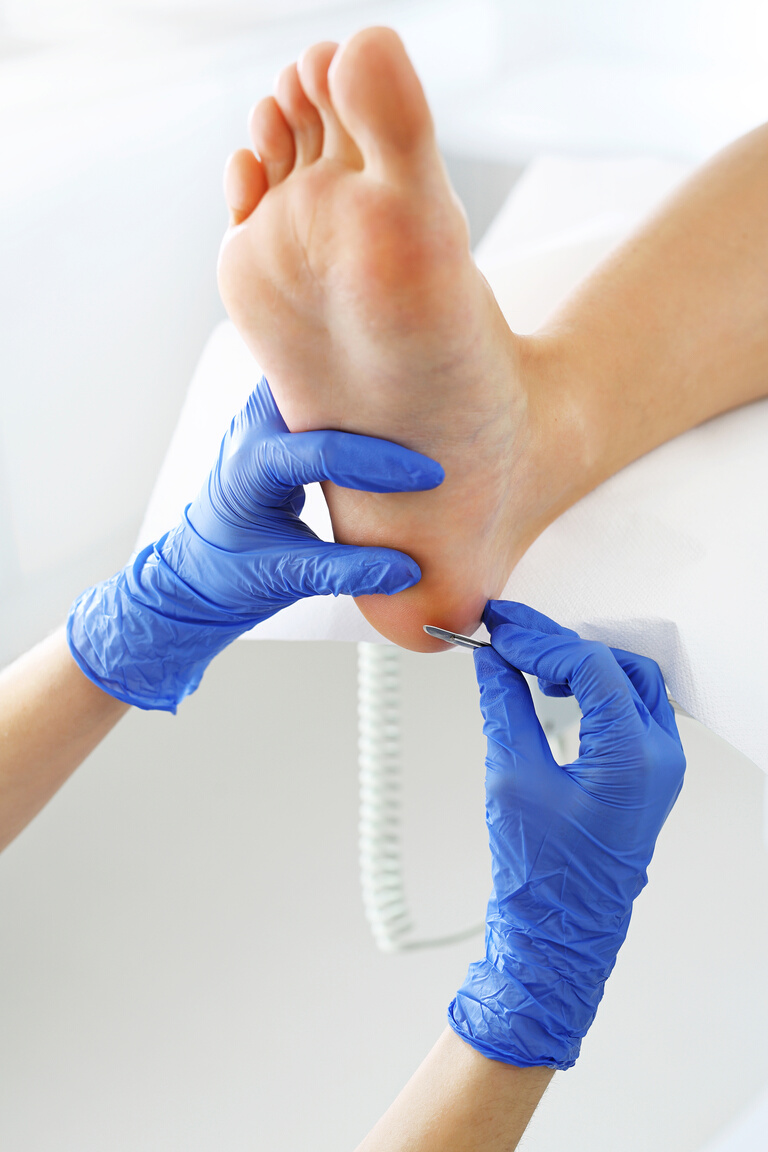 Pedicure treatment